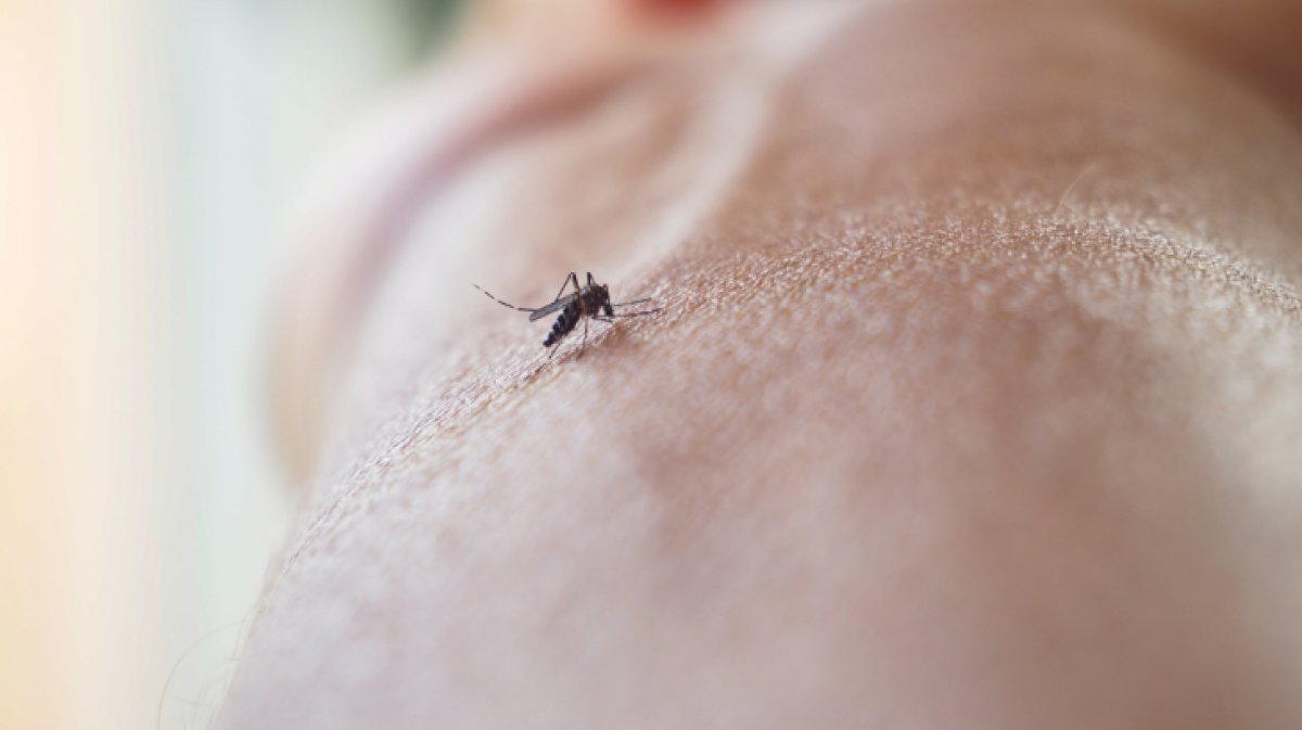 Sivrisinek Isırığına Ne İyi Gelir? Sivrisinek Isırığı Nasıl Geçer?